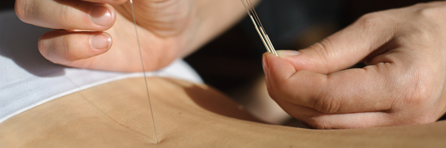 acupuncture à domicile